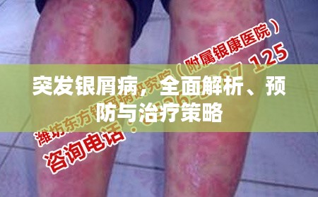 突发银屑病，全面解析、预防与治疗策略
